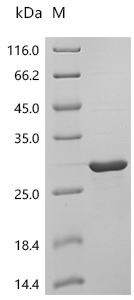 Recombinant Human Lipocalin-1 (LCN1) - image 1