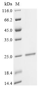 Recombinant Human Epididymal-specific lipocalin-6 (LCN6) - image 1