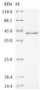 (Tris-Glycine gel) Discontinuous SDS-PAGE (reduced) with 5% enrichment gel and 15% separation gel.