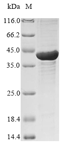 Recombinant Human Left-right determination factor 2 (LEFTY2) - image 1