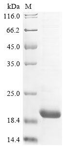 (Tris-Glycine gel) Discontinuous SDS-PAGE (reduced) with 5% enrichment gel and 15% separation gel. (Tris-Glycine gel) Discontinuous SDS-PAGE (reduced) with 5% enrichment gel and 15% separation gel.