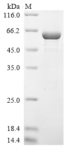 (Tris-Glycine gel) Discontinuous SDS-PAGE (reduced) with 5% enrichment gel and 15% separation gel. (Tris-Glycine gel) Discontinuous SDS-PAGE (reduced) with 5% enrichment gel and 15% separation gel.