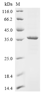 Recombinant Rat Lutropin-choriogonadotropic hormone receptor (Lhcgr) , partial - image 1