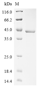 (Tris-Glycine gel) Discontinuous SDS-PAGE (reduced) with 5% enrichment gel and 15% separation gel. (Tris-Glycine gel) Discontinuous SDS-PAGE (reduced) with 5% enrichment gel and 15% separation gel.