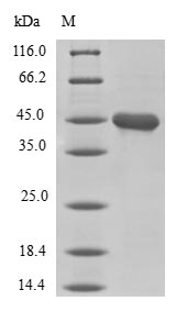 (Tris-Glycine gel) Discontinuous SDS-PAGE (reduced) with 5% enrichment gel and 15% separation gel. (Tris-Glycine gel) Discontinuous SDS-PAGE (reduced) with 5% enrichment gel and 15% separation gel.