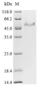 (Tris-Glycine gel) Discontinuous SDS-PAGE (reduced) with 5% enrichment gel and 15% separation gel. (Tris-Glycine gel) Discontinuous SDS-PAGE (reduced) with 5% enrichment gel and 15% separation gel.