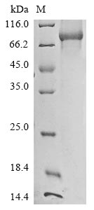 (Tris-Glycine gel) Discontinuous SDS-PAGE (reduced) with 5% enrichment gel and 15% separation gel. (Tris-Glycine gel) Discontinuous SDS-PAGE (reduced) with 5% enrichment gel and 15% separation gel.