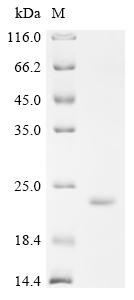 Recombinant Human Lysozyme C (LYZ) - image 1