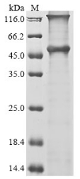 Recombinant Human Melanoma-associated antigen 12 (MAGEA12) - image 1
