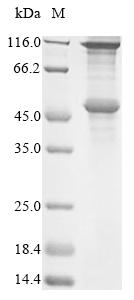 Recombinant Human Melanoma-associated antigen 2 (MAGEA2) - image 1