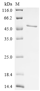 Recombinant Human Melanoma-associated antigen 3 (MAGEA3) - image 1