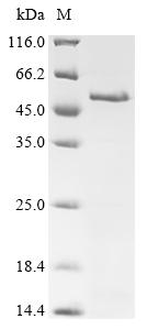 Recombinant Human Melanoma-associated antigen 4 (MAGEA4) - image 1