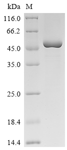 Recombinant Human Melanoma-associated antigen B3 (MAGEB3) - image 1