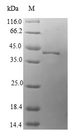 (Tris-Glycine gel) Discontinuous SDS-PAGE (reduced) with 5% enrichment gel and 15% separation gel. (Tris-Glycine gel) Discontinuous SDS-PAGE (reduced) with 5% enrichment gel and 15% separation gel.