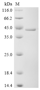 (Tris-Glycine gel) Discontinuous SDS-PAGE (reduced) with 5% enrichment gel and 15% separation gel.