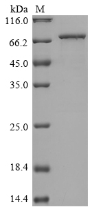 (Tris-Glycine gel) Discontinuous SDS-PAGE (reduced) with 5% enrichment gel and 15% separation gel. (Tris-Glycine gel) Discontinuous SDS-PAGE (reduced) with 5% enrichment gel and 15% separation gel.