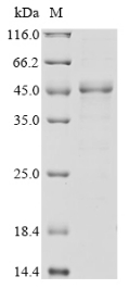 (Tris-Glycine gel) Discontinuous SDS-PAGE (reduced) with 5% enrichment gel and 15% separation gel. (Tris-Glycine gel) Discontinuous SDS-PAGE (reduced) with 5% enrichment gel and 15% separation gel.