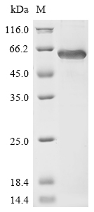 Recombinant Human Cartilage matrix protein (MATN1) - image 1