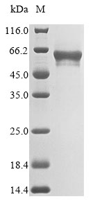 Recombinant Human Matrilin-3 (MATN3) - image 1