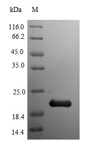 (Tris-Glycine gel) Discontinuous SDS-PAGE (reduced) with 5% enrichment gel and 15% separation gel. (Tris-Glycine gel) Discontinuous SDS-PAGE (reduced) with 5% enrichment gel and 15% separation gel.