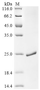Recombinant Pig Myoglobin (MB) - image 1