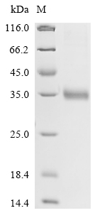 Recombinant Rat Mannose-binding protein C (Mbl2) - image 1