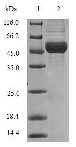 SDS-PAGE- Recombinant protein Brucella mdh