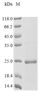 Recombinant Chicken Midkine (RIHB) - image 1