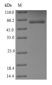 SDS-PAGE- Recombinant protein Human MET