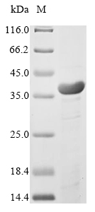 (Tris-Glycine gel) Discontinuous SDS-PAGE (reduced) with 5% enrichment gel and 15% separation gel.