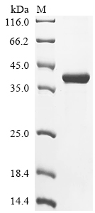 (Tris-Glycine gel) Discontinuous SDS-PAGE (reduced) with 5% enrichment gel and 15% separation gel. (Tris-Glycine gel) Discontinuous SDS-PAGE (reduced) with 5% enrichment gel and 15% separation gel.