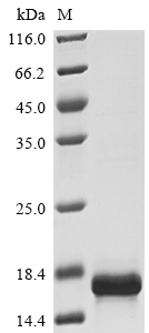 Recombinant Human Macrophage migration inhibitory factor (MIF) - image 1