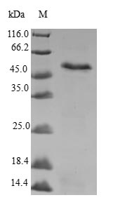 (Tris-Glycine gel) Discontinuous SDS-PAGE (reduced) with 5% enrichment gel and 15% separation gel. (Tris-Glycine gel) Discontinuous SDS-PAGE (reduced) with 5% enrichment gel and 15% separation gel.