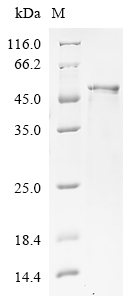 (Tris-Glycine gel) Discontinuous SDS-PAGE (reduced) with 5% enrichment gel and 15% separation gel. (Tris-Glycine gel) Discontinuous SDS-PAGE (reduced) with 5% enrichment gel and 15% separation gel.