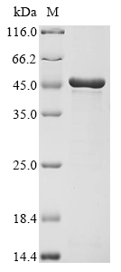 (Tris-Glycine gel) Discontinuous SDS-PAGE (reduced) with 5% enrichment gel and 15% separation gel. (Tris-Glycine gel) Discontinuous SDS-PAGE (reduced) with 5% enrichment gel and 15% separation gel.