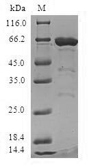 (Tris-Glycine gel) Discontinuous SDS-PAGE (reduced) with 5% enrichment gel and 15% separation gel. (Tris-Glycine gel) Discontinuous SDS-PAGE (reduced) with 5% enrichment gel and 15% separation gel.