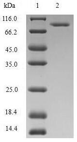 (Tris-Glycine gel) Discontinuous SDS-PAGE (reduced) with 5% enrichment gel and 15% separation gel.