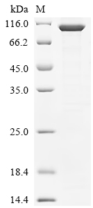 (Tris-Glycine gel) Discontinuous SDS-PAGE (reduced) with 5% enrichment gel and 15% separation gel. (Tris-Glycine gel) Discontinuous SDS-PAGE (reduced) with 5% enrichment gel and 15% separation gel.
