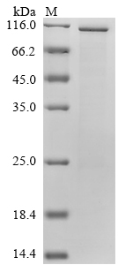 (Tris-Glycine gel) Discontinuous SDS-PAGE (reduced) with 5% enrichment gel and 15% separation gel. (Tris-Glycine gel) Discontinuous SDS-PAGE (reduced) with 5% enrichment gel and 15% separation gel.