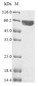 CSB-EP015270HU SDS-PAGE