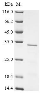 Recombinant Human Protein L-Myc (MYCL) , partial - image 1