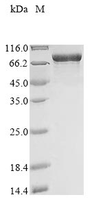 Recombinant Human Myosin-6 (MYH6) , partial - image 1