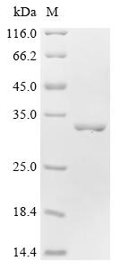 Recombinant Bovine Myosin light chain 3 (MYL3) - image 1