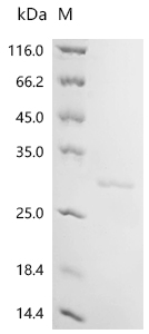 Recombinant Human Myosin regulatory light polypeptide 9 (MYL9) - image 1