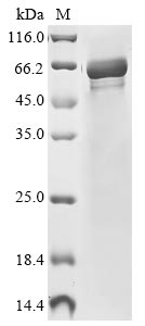 (Tris-Glycine gel) Discontinuous SDS-PAGE (reduced) with 5% enrichment gel and 15% separation gel. (Tris-Glycine gel) Discontinuous SDS-PAGE (reduced) with 5% enrichment gel and 15% separation gel.
