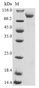 Recombinant Human Neuron navigator 1 (NAV1) , partial - image 1