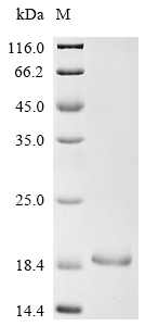 Recombinant Mouse Neuron navigator 3 (Nav3) , partial - image 1