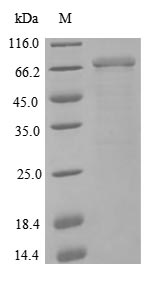 SDS-PAGE- Recombinant protein Human NCAM1