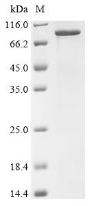 Recombinant Mouse Neural cell adhesion molecule 1 (Ncam1) , partial - image 1
