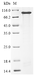 Recombinant Mouse Neural cell adhesion molecule 1 (Ncam1) , partial - image 1